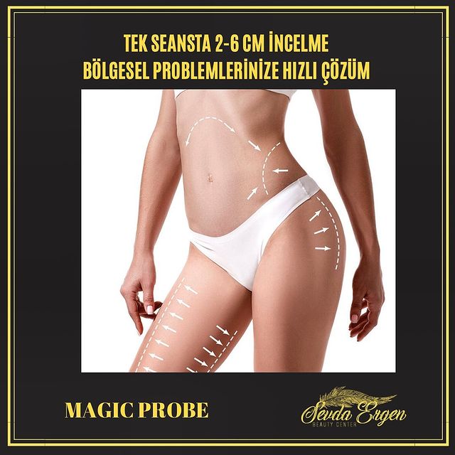 Magic Probe İle Bölgesel İncelme